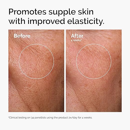 The Ordinary Hyaluronic Acid 2% + B5 (with Ceramides), Multi-Depth Hydration Serum for Plumper, Smoother Skin